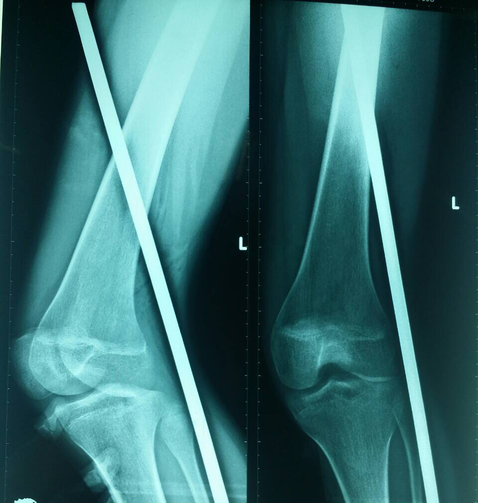 Vat nhon dam thau chan anh 1