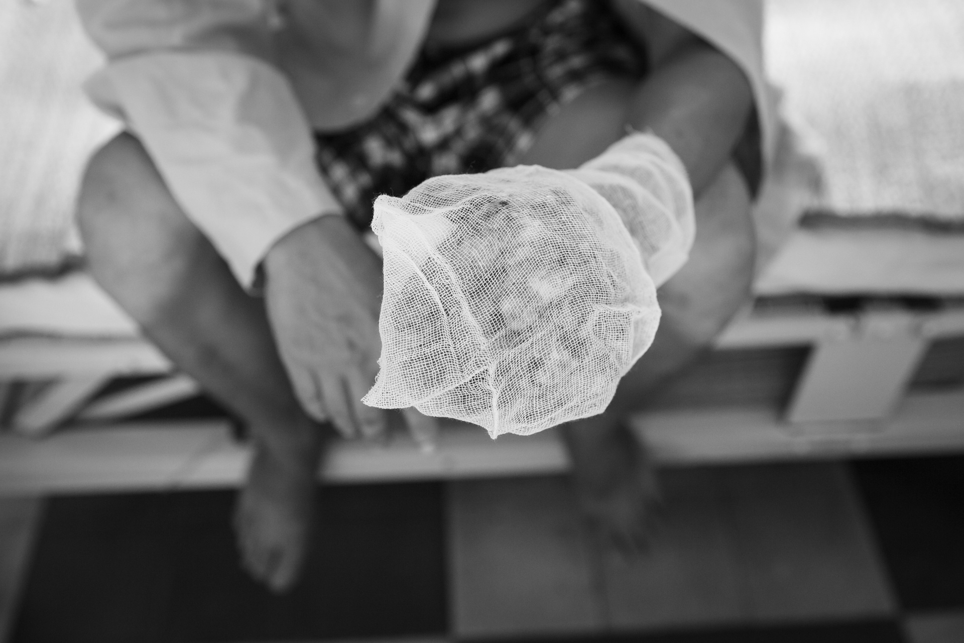 Công nhân bị dập nát bàn tay  ảnh 2 Cong nhan bi dap nat ban tay anh 2