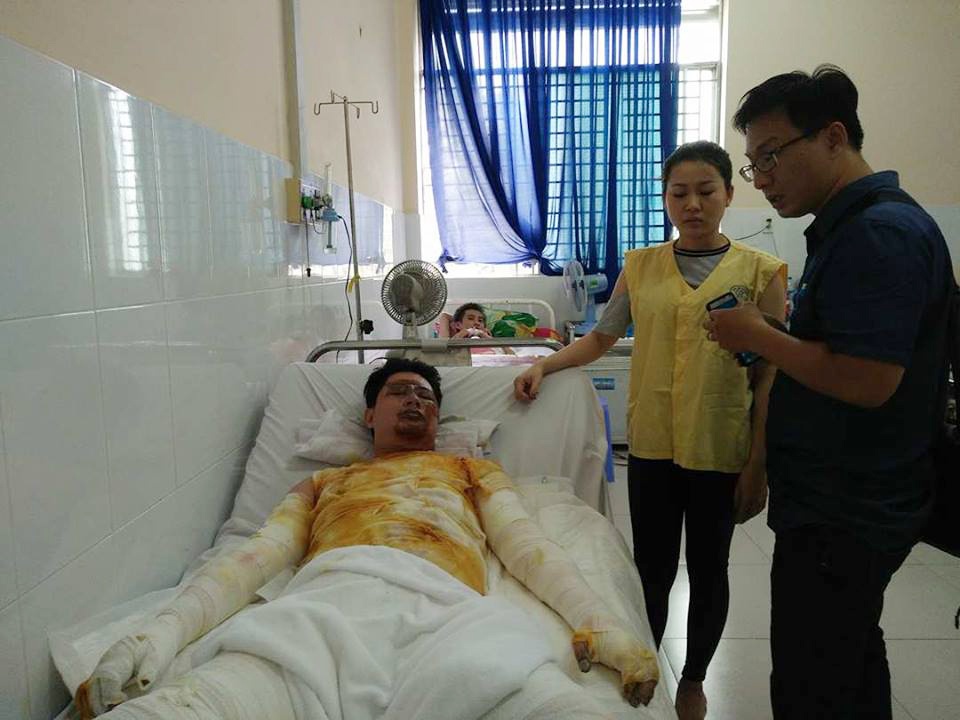 Phỏng nặng do cháy môtô BMW ảnh 1 Phong nang do chay moto BMW anh 1