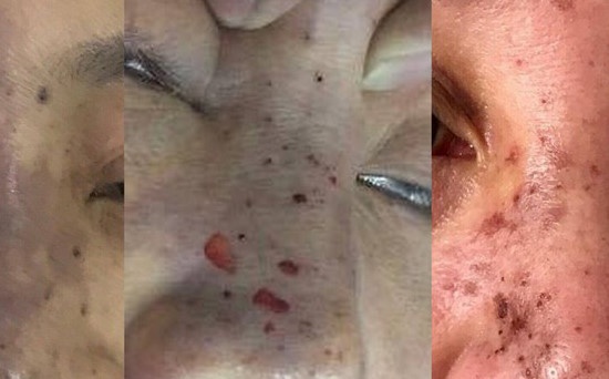 Hiem hoa tu nhung co so lam dep 'chui' hinh anh