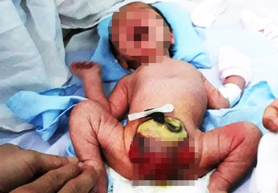 Di dang bo phan sinh duc anh 1