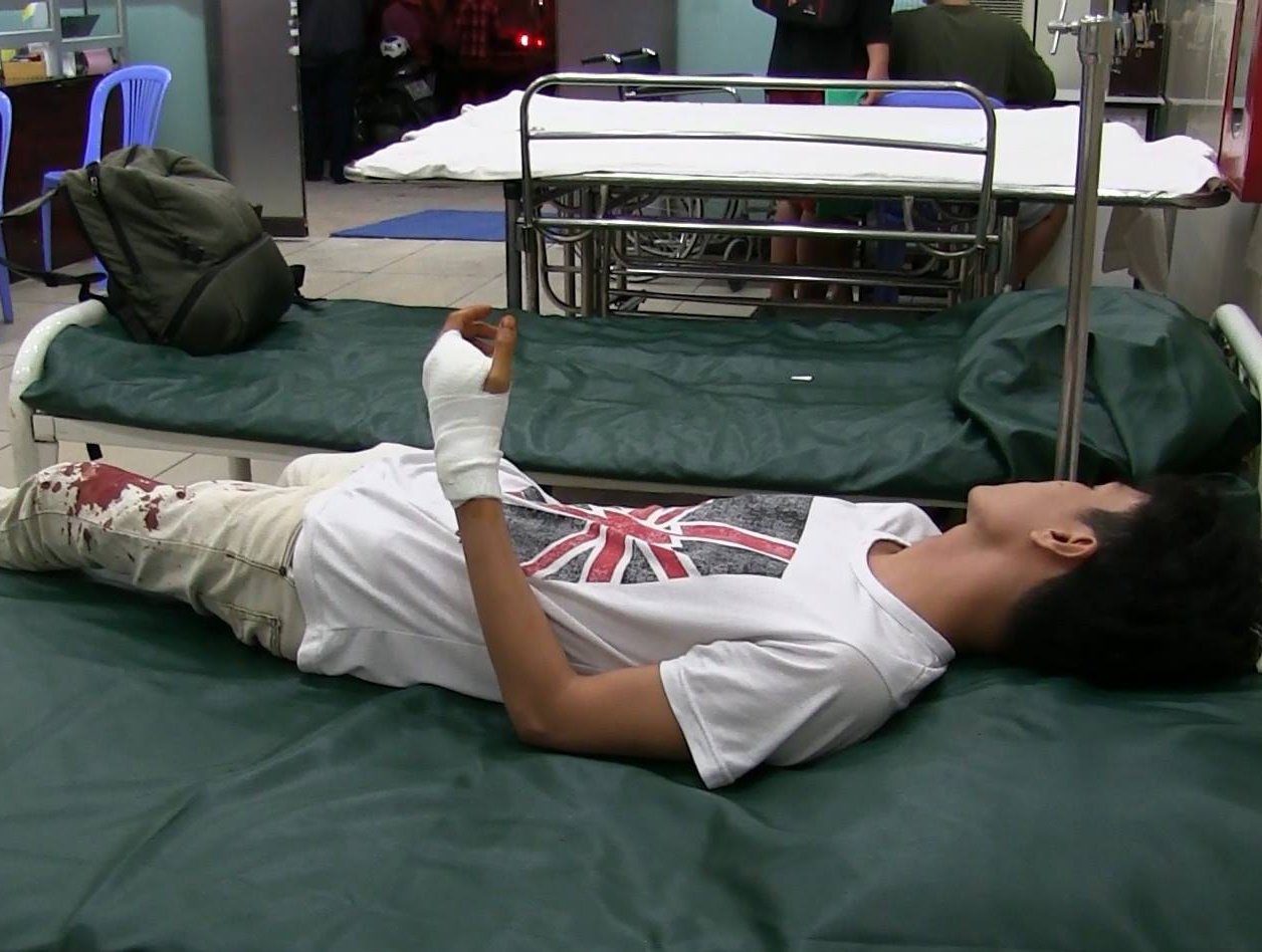 GrabBike hon chien anh 2