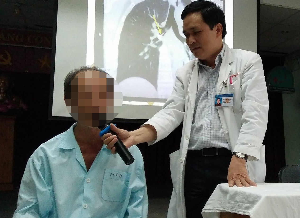Hóc xương cá ảnh 2 Hoc xuong ca anh 2