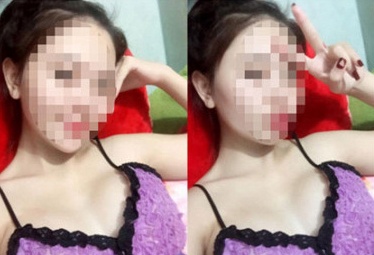 Thai phu nang nguc tu vong do phat benh lupus ban do hinh anh