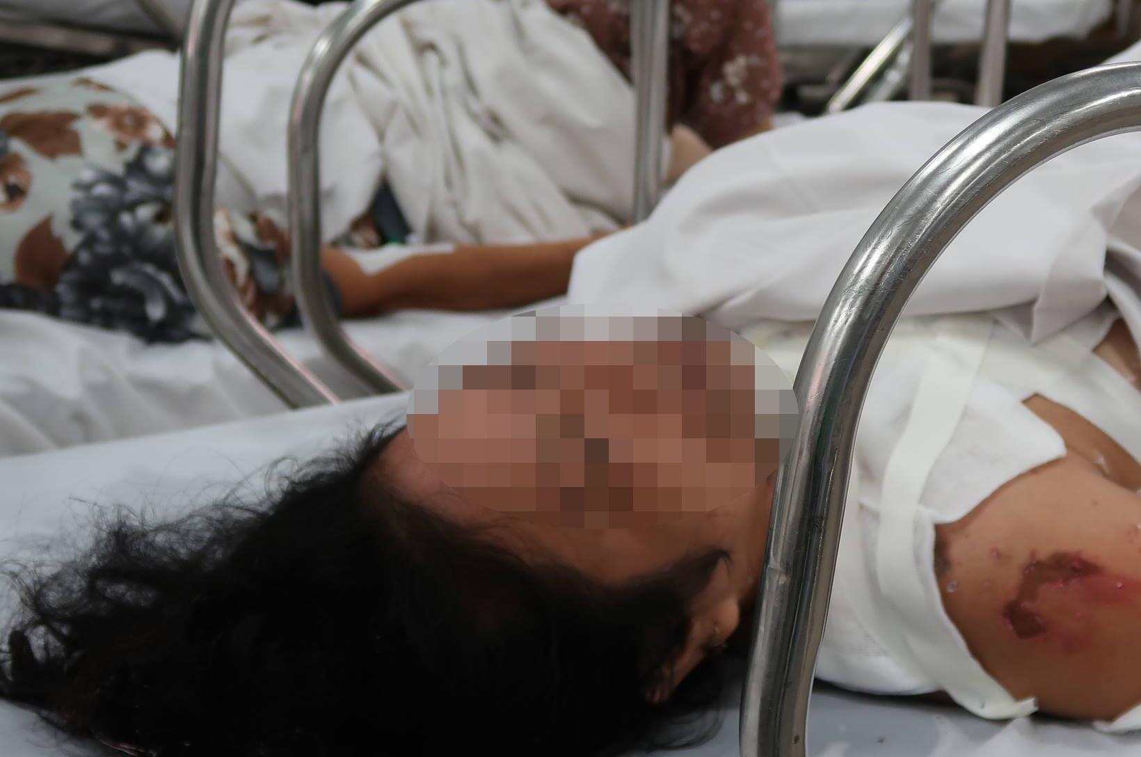 Cu ong 70 tuoi tat axit vao mat vo ho vi ghen hinh anh