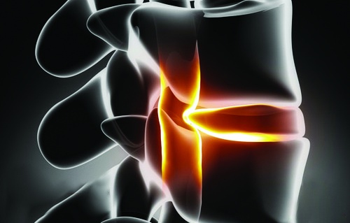 Suýt tàn tật vì nằm võng ảnh 1 Suyt tan tat vi nam vong anh 1