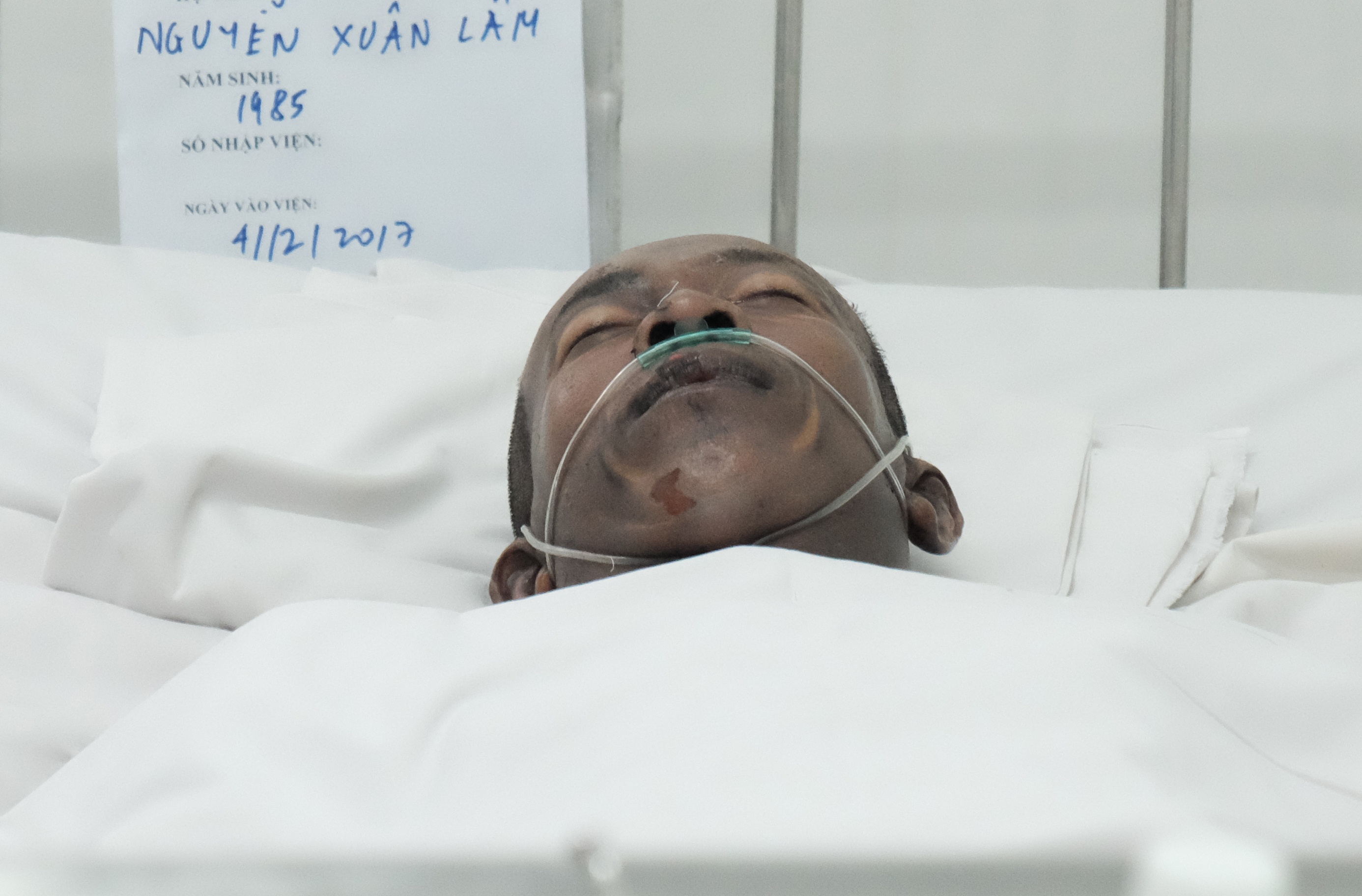 Em trai cua chu nha tu vong cung 2 con bong nang hinh anh