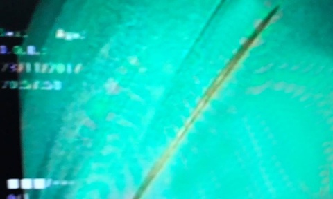 Thung ta trang vi nuot tam anh 1