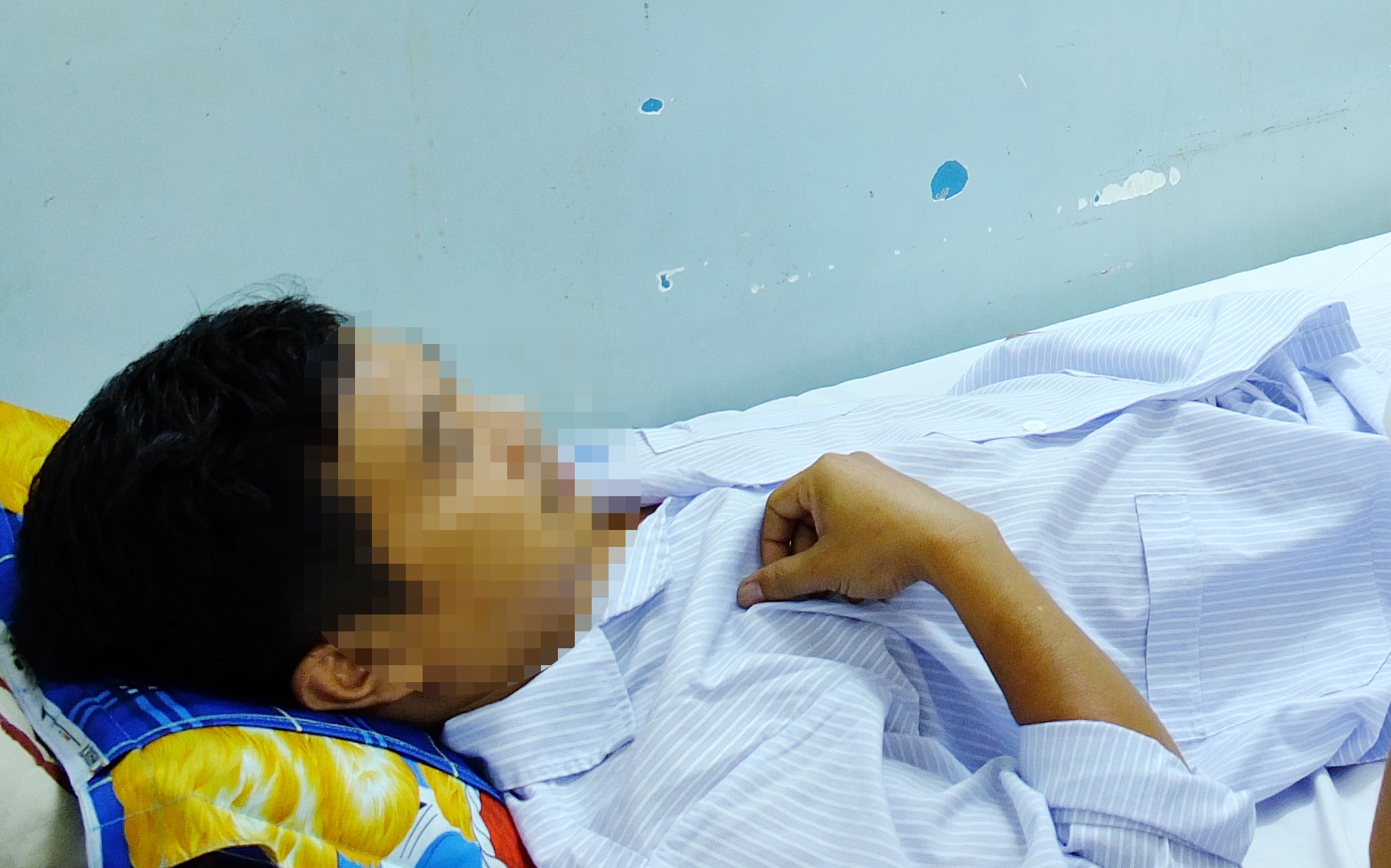 Ba benh nhan lien tiep nhap vien vi tam, xuong ca dam thung ruot hinh anh
