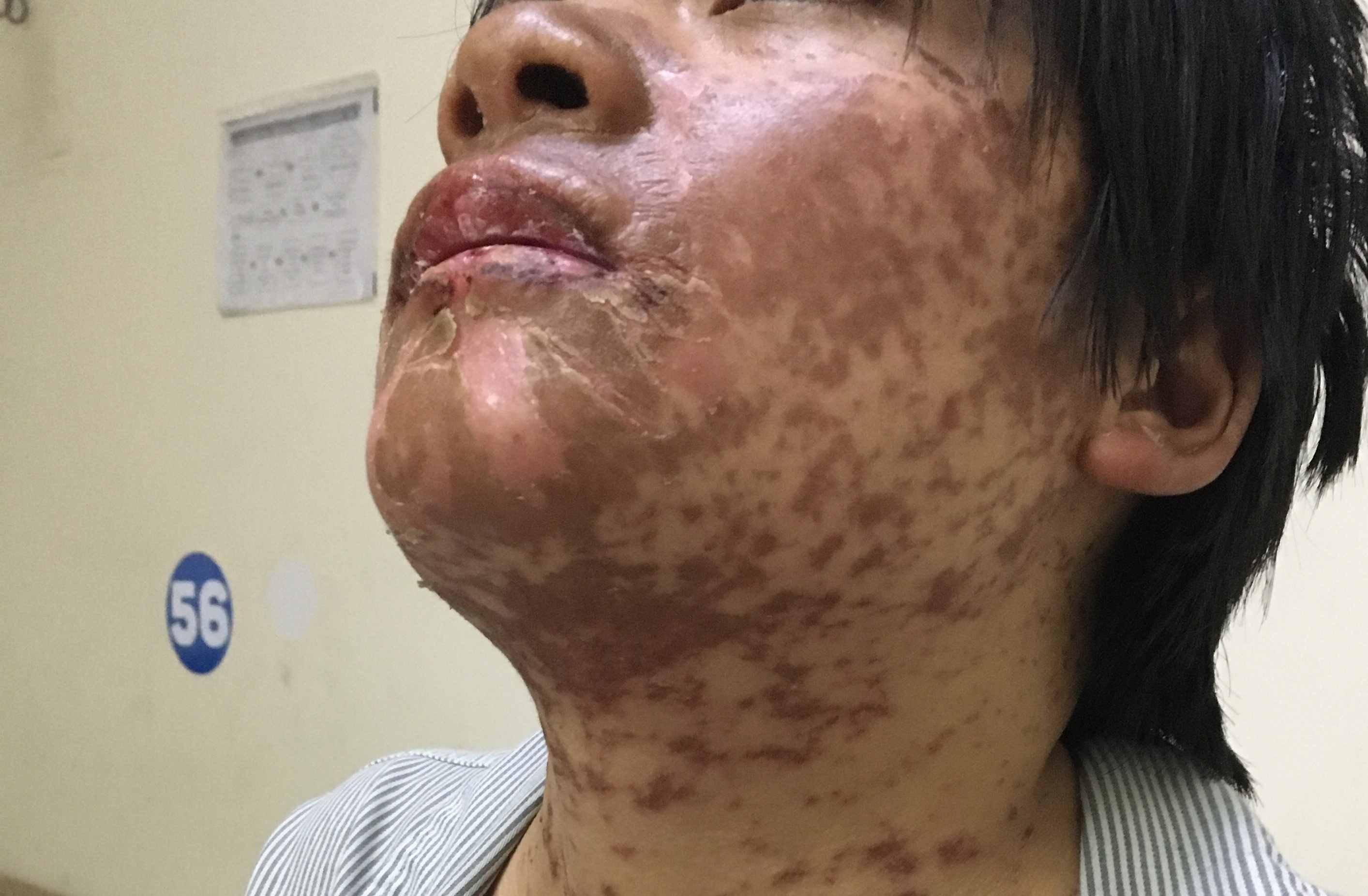 Cô gái biến dạng khuôn mặt ảnh 1 Co gai bien dang khuon mat anh 1