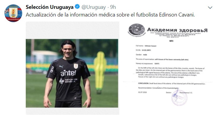 Bình phục chấn thương, Cavani sẵn sàng đối đầu với Pháp ảnh 1 Binh phuc chan thuong, Cavani san sang doi dau voi Phap anh 1