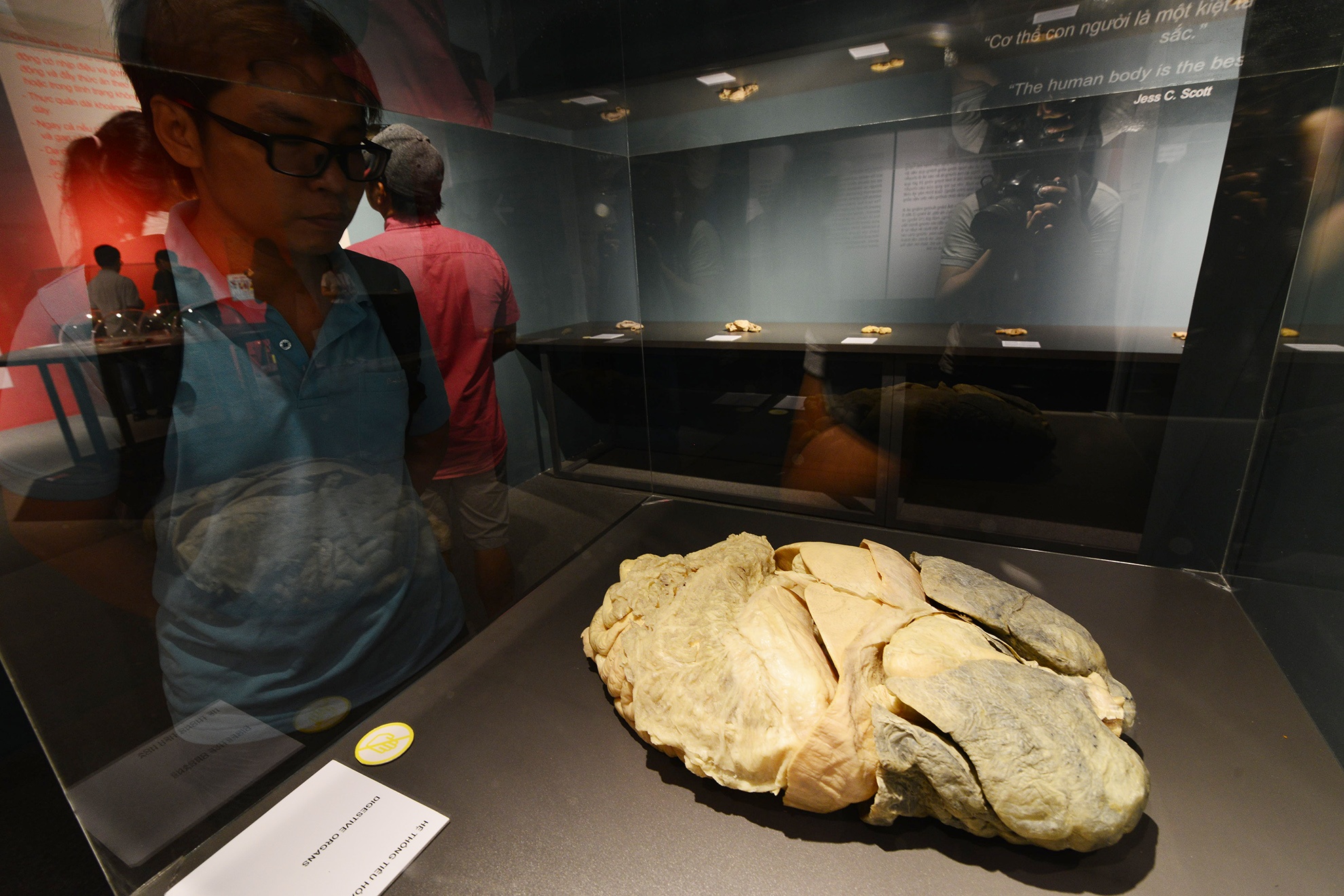 trien lam xac nguoi that day am anh o Sai Gon anh 10