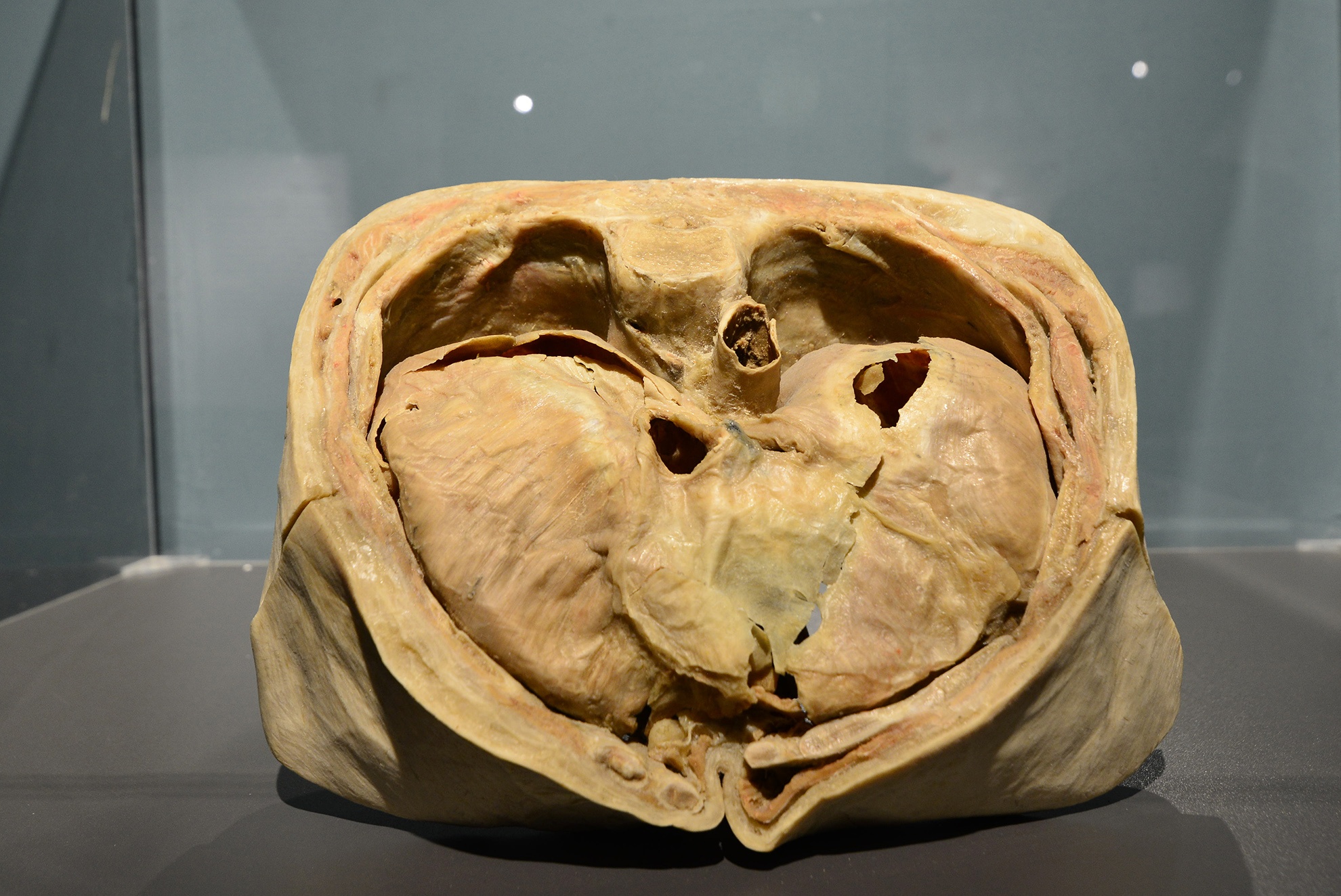 trien lam xac nguoi that day am anh o Sai Gon anh 11