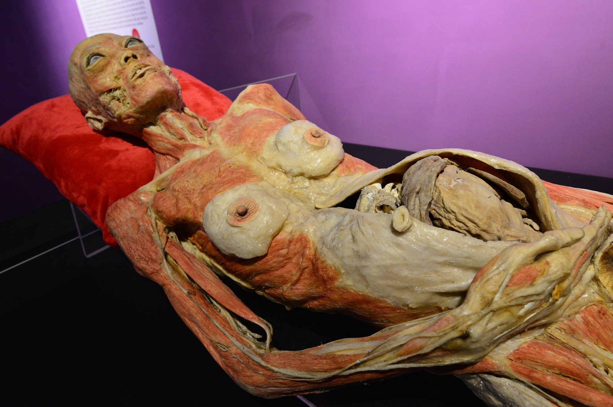 trien lam xac nguoi that day am anh o Sai Gon anh 13