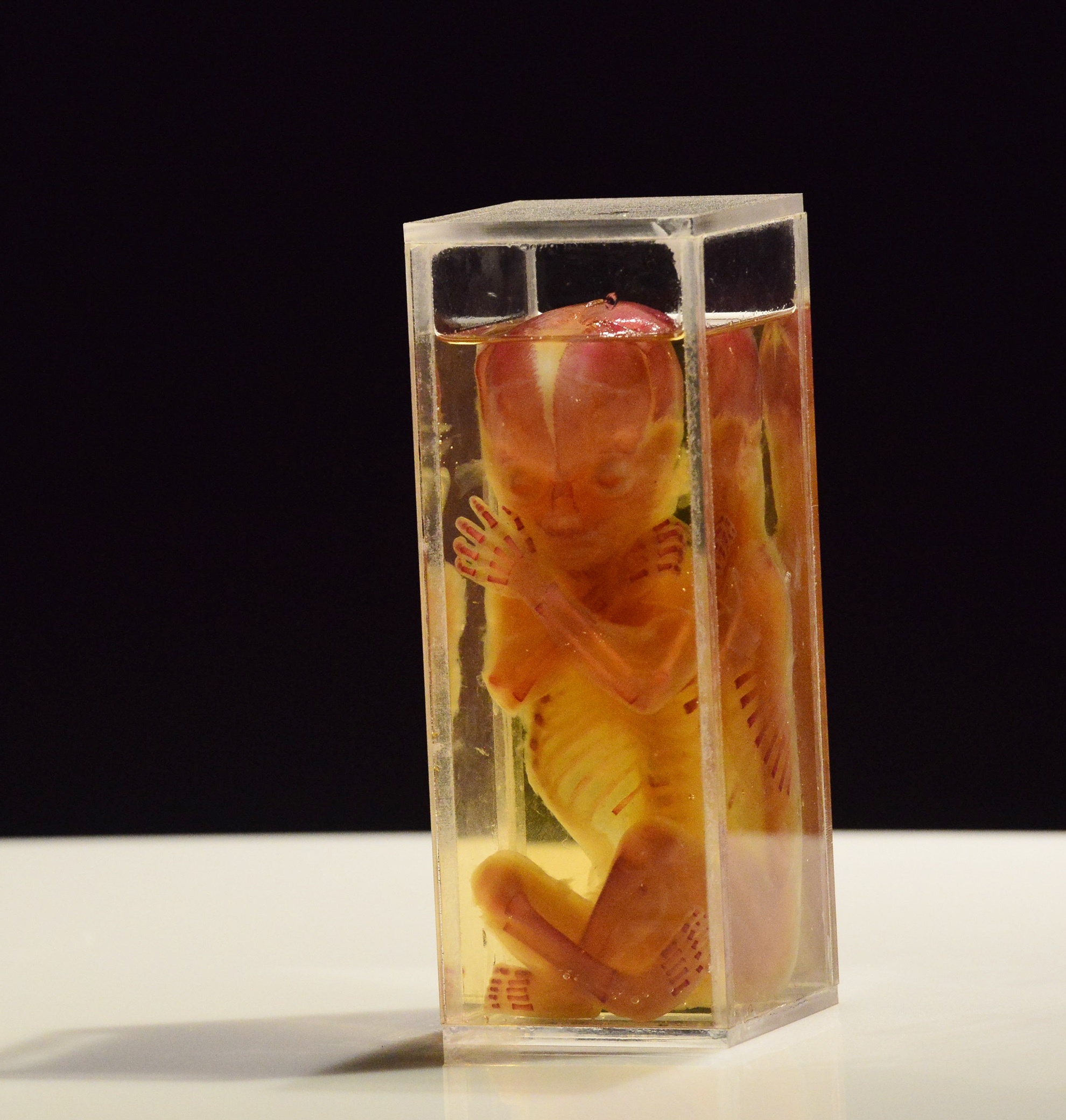 trien lam xac nguoi that day am anh o Sai Gon anh 15