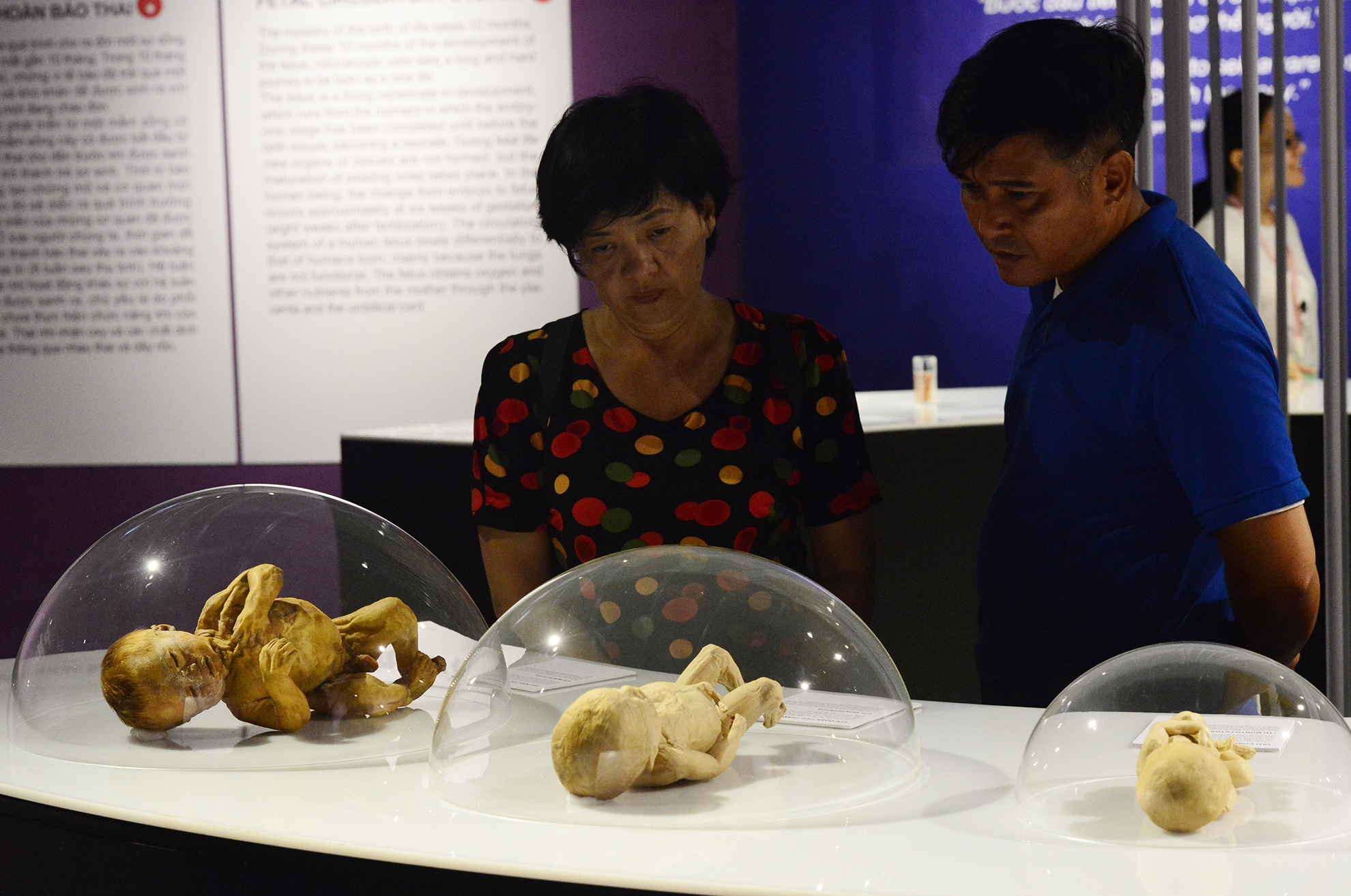 trien lam xac nguoi that day am anh o Sai Gon anh 14