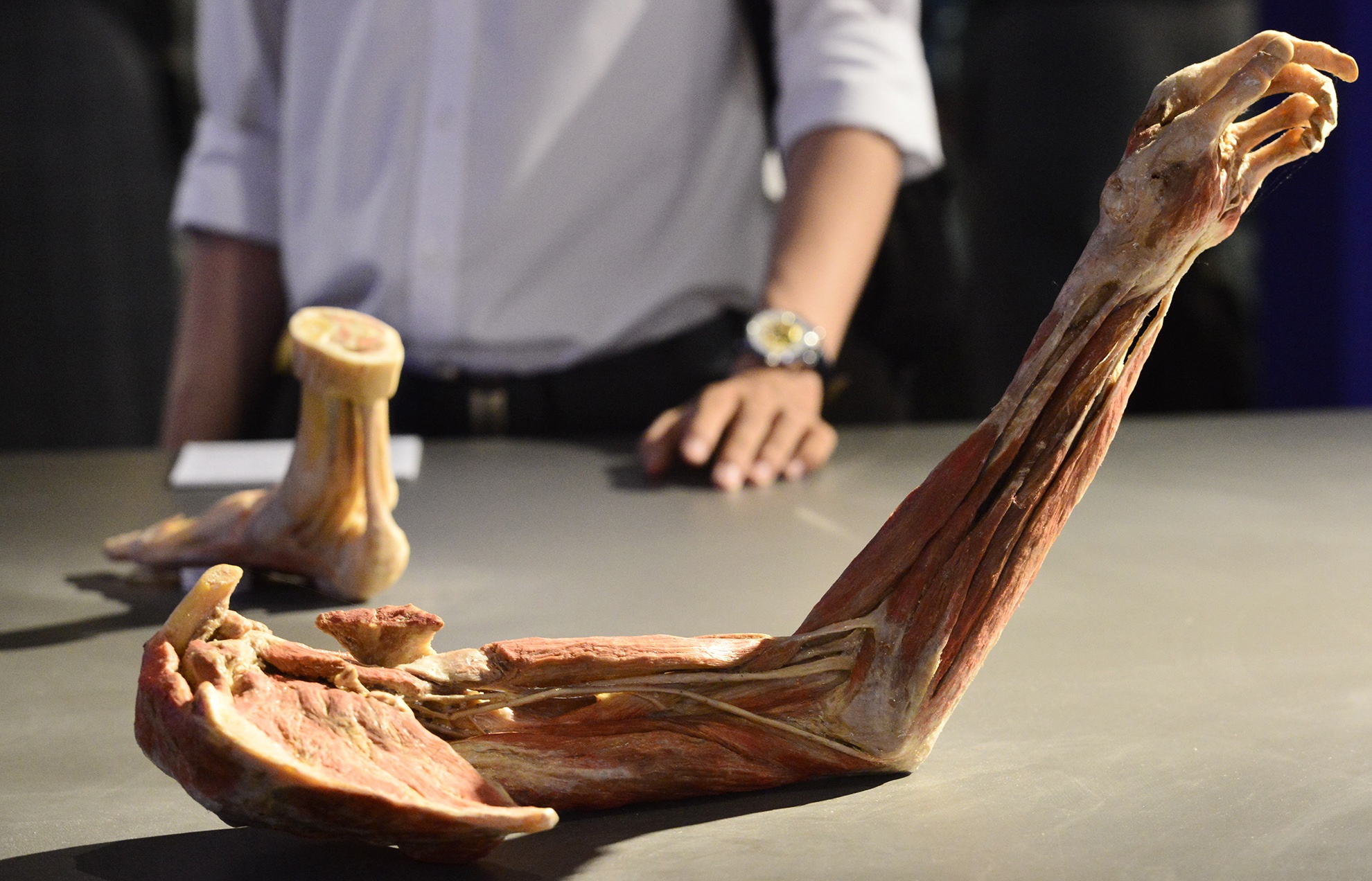 trien lam xac nguoi that day am anh o Sai Gon anh 4