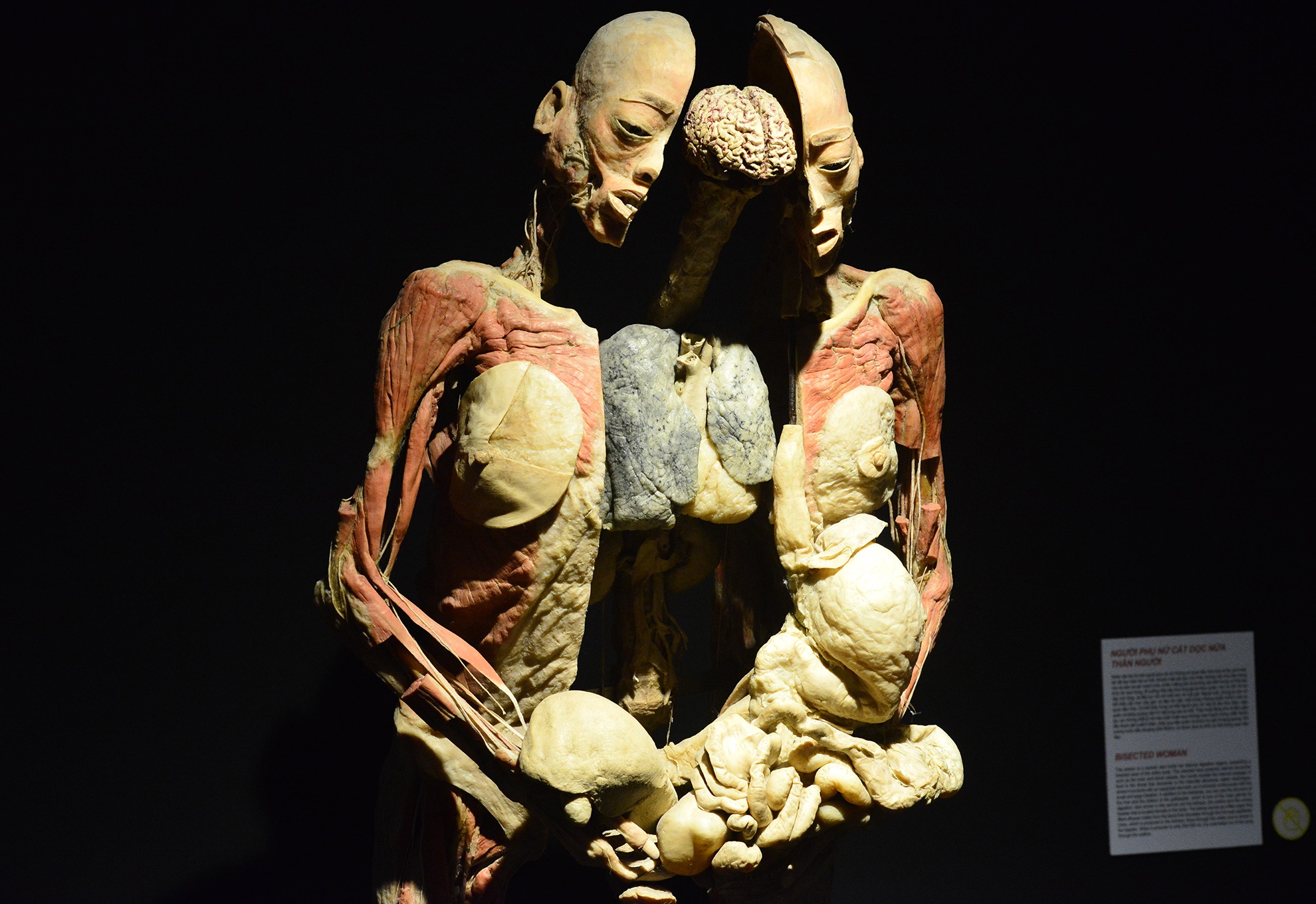 trien lam xac nguoi that day am anh o Sai Gon anh 8