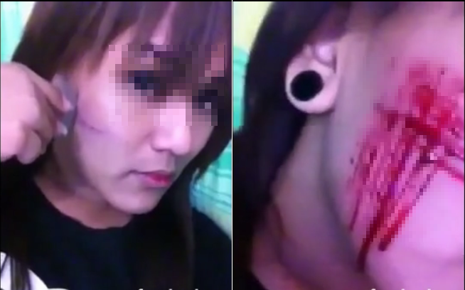 Cong dong mang lat tay clip rach mat cua mot co gai hinh anh