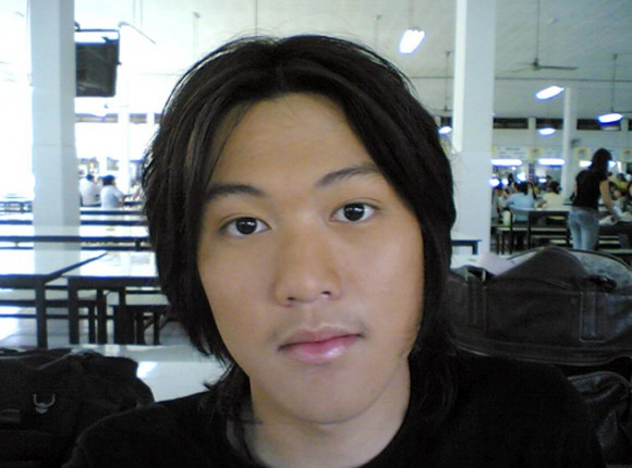 Lot xac thanh my nam sau 50 lan phau thuat tham my hinh anh