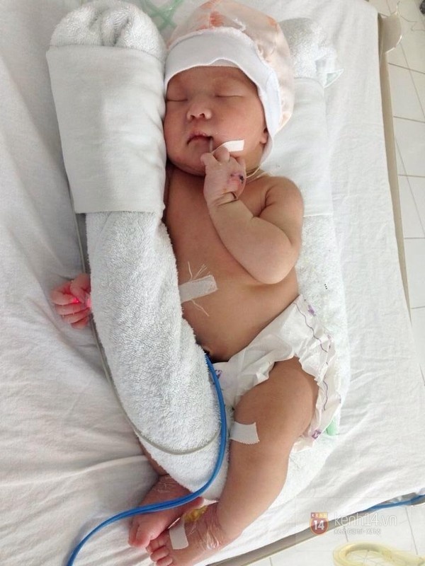 Bé Cìu đã biết giơ tay lên má làm điệu và ăn được sữa mẹ.