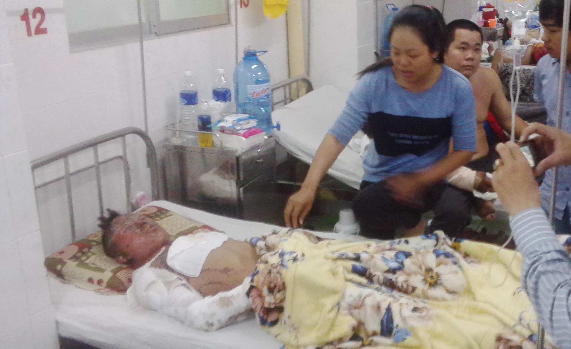 Vua rut xang vua hut thuoc, nam thanh nien bi bong nang hinh anh