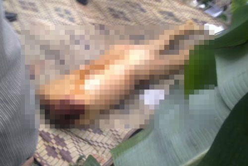 Dieu tra nguoi dan ong mat dau o Ha Giang hinh anh