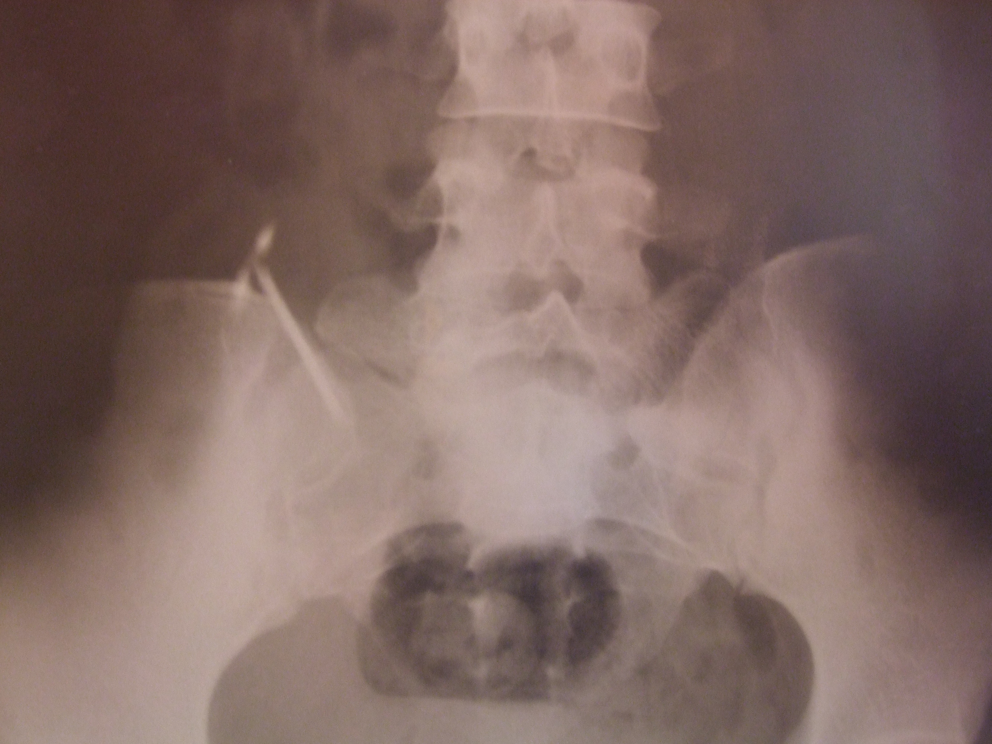 Vong tranh thai dat sai da xuyen thung tu cung hinh anh