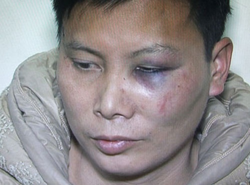 Ke dam chet bo chu no ra dau thu hinh anh