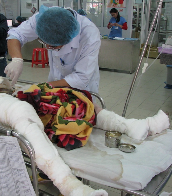 Cha cua co gai bi dot ke ve con gai hinh anh