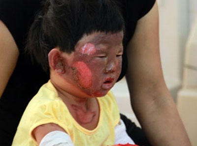 Do xang, 5 nguoi trong mot gia dinh phong nang hinh anh