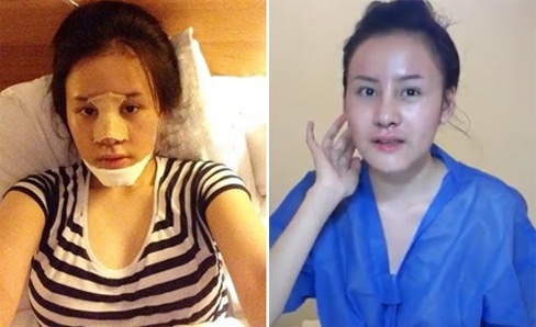 Can mat cac hot girl Viet sau phau thuat tham my hinh anh