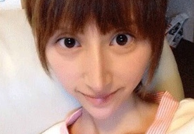 Co gai co guong mat yeu tinh sau phau thuat hinh anh