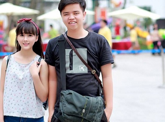 Nhung nguoi tre ky cuc chi thich khoe mat xau hinh anh