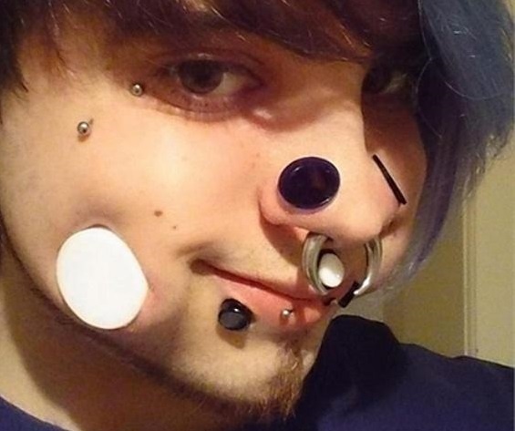 Chang trai lam dep bang cach khoet da duc thit hinh anh