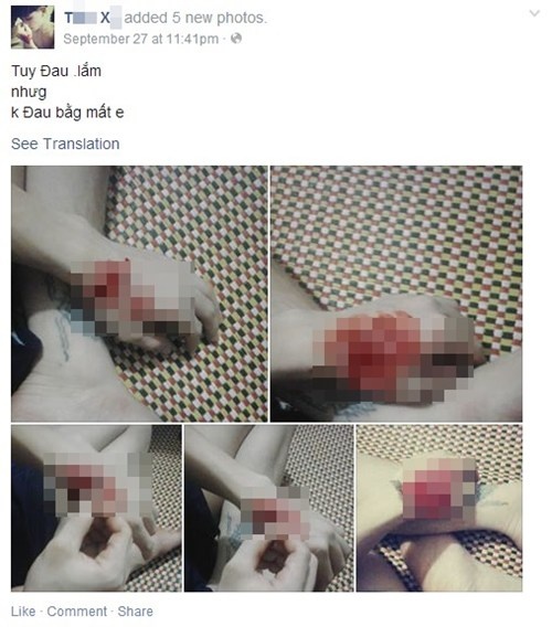  Chàng trai đăng hình ảnh lấy dao lam tách nát nhừ cổ tay cùng theo với những loại tế bào mô tả thể hiện tại sự đau nhức, tiếc nuối lên trang cá thể. 