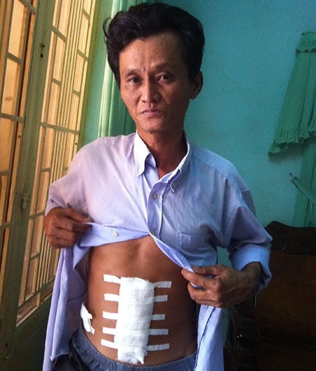 Ông Dũng tố bị hiệu trưởng đánh vỡ ruột.