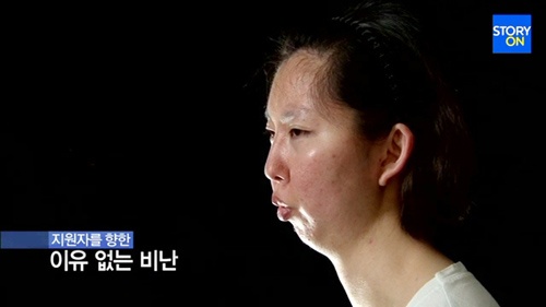 Nhìn nghiêng, Kim Hyo Jeong gần như không có cằm.