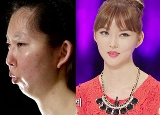 Man lot xac ngoan muc cua co gai khong co cam hinh anh