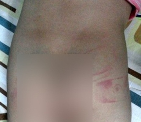 Be 3 tuoi bi co giao danh bam dap vi di tieu nhieu hinh anh