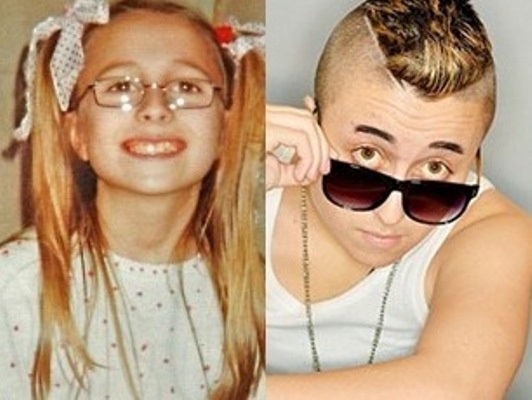 Co gai phau thuat chuyen gioi giong Justin Bieber hinh anh