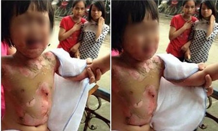 Hình ảnh thương tâm được chia sẻ trên mạng xã hội.