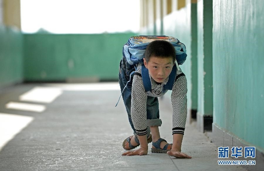 Nhập mô tả ch1o ảnh