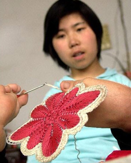 Chị Mã có thể xỏ kim được bằng chân.