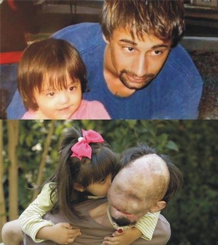 Một trong những bức ảnh về tình cha con được chia sẻ rộng rãi. Ảnh: Internet.