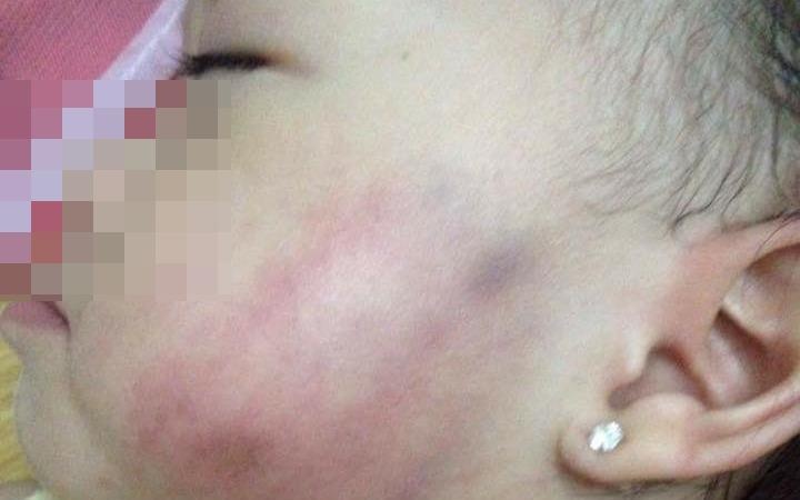 Cong an dieu tra vu gia dinh to co giao tat be gai bam mat hinh anh
