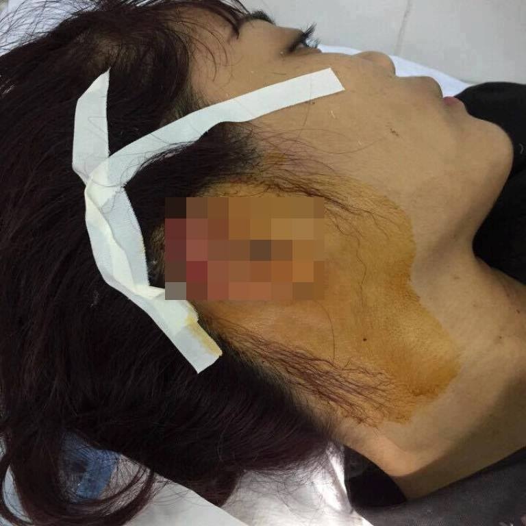 giáo viên tố phụ huynh cắn đứt tai ảnh 1 giao vien to phu huynh can dut tai anh 1