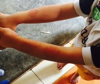 Cach chuc hieu truong doc nguoc tre vao may vat long ga hinh anh