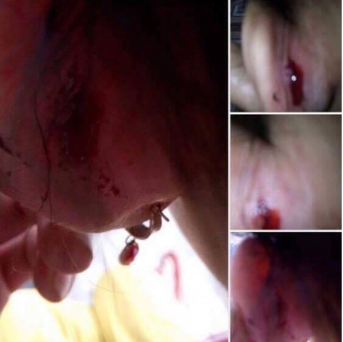 cô giáo bị tố véo tai học sinh ảnh 1 co giao bi to veo tai hoc sinh anh 1