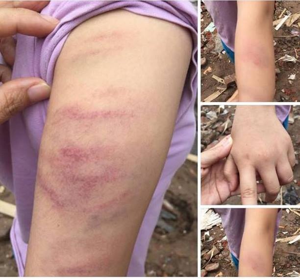 co giao danh bam tim tay hoc sinh anh 1